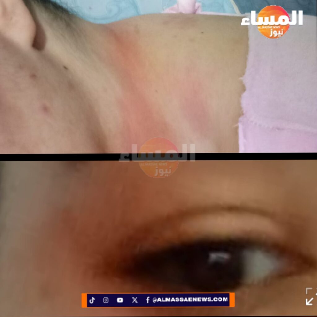الداخلة: مطالب بتدخل أمني عاجل بعد تعرض سيدة للاعتداء الجسدي بحي الوحدة